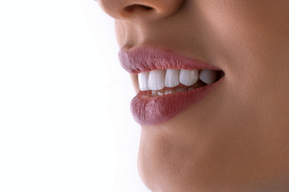 Professional dental photo
